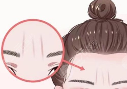 骨相抗衰原理是什么？