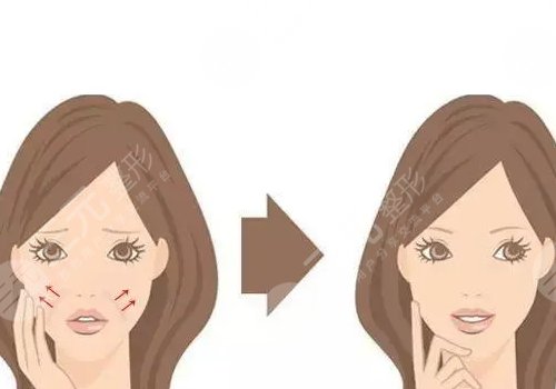 骨相抗衰原理是什么？