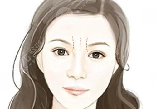 骨相抗衰原理是什么？