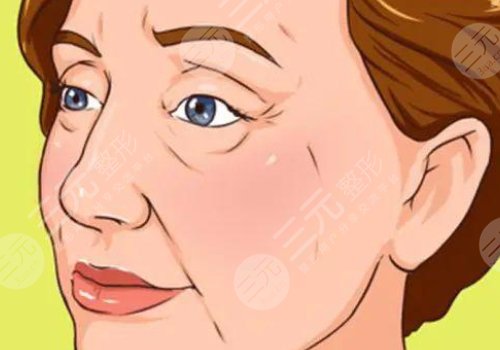 皮膚松弛做什么醫(yī)美項(xiàng)目？