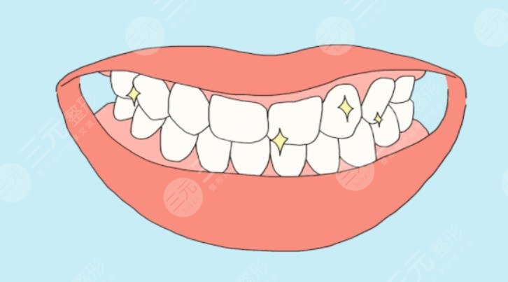 天津青苗兒童口腔醫(yī)院怎么樣?
