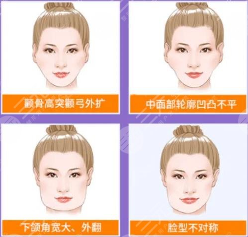 面部填充