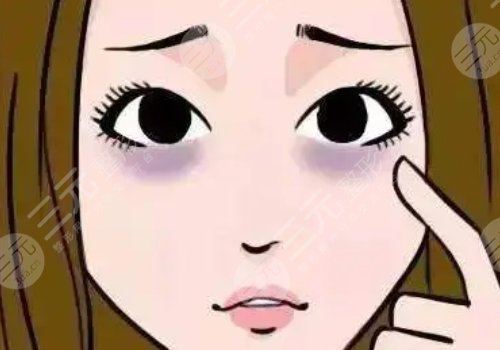 去黑眼圈的醫(yī)美項(xiàng)目多少錢？有哪些？