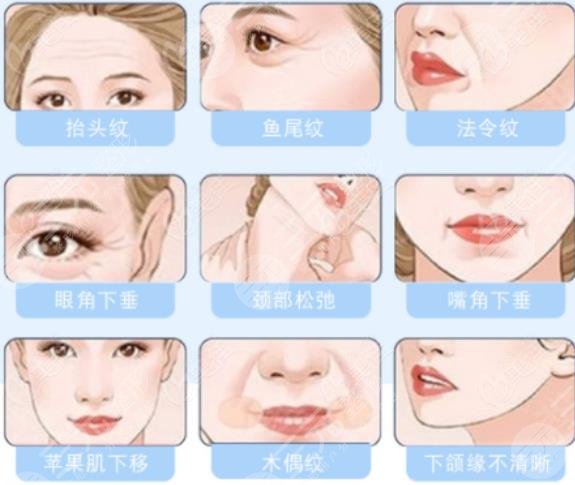 雙矢量提升術多大歲數能做