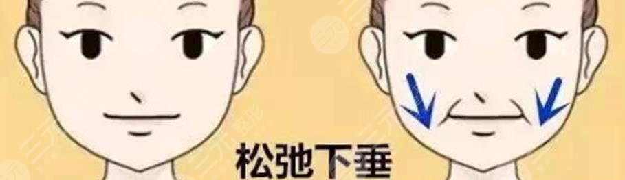 下頜緣提升