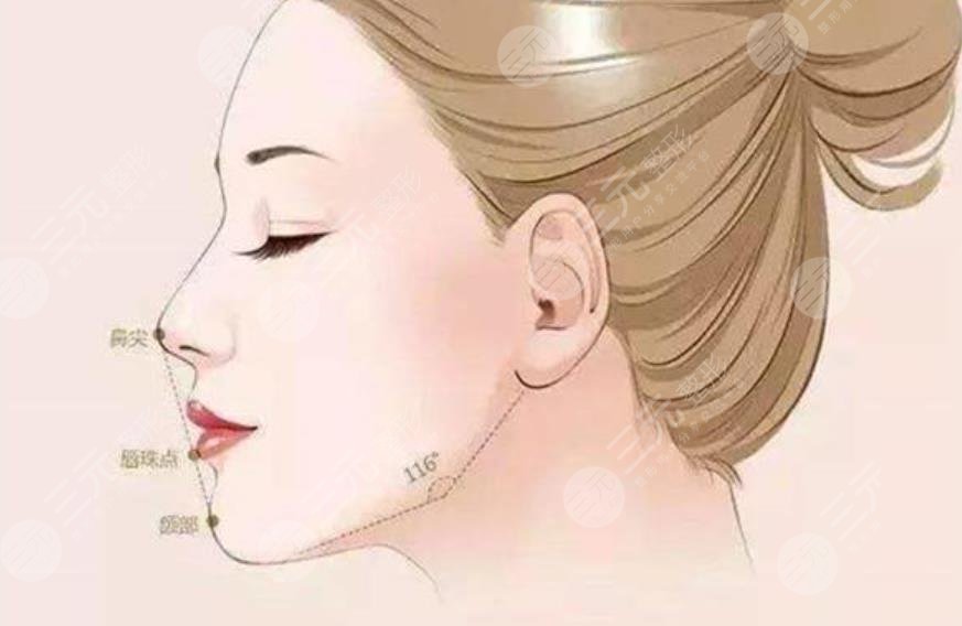 下頜緣提升