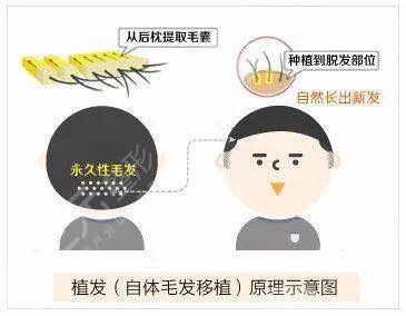 中國醫(yī)學(xué)科學(xué)院整形外科醫(yī)院植發(fā)醫(yī)生簡(jiǎn)介