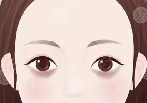 去黑眼圈手術(shù)多少錢(qián)啊？