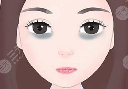 去黑眼圈手術(shù)多少錢啊？