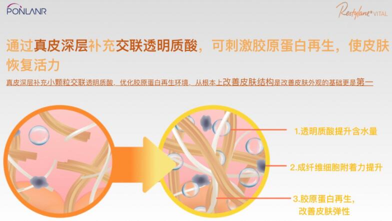 貴婦水光效果怎么樣？高奢維養(yǎng)，美膚指南！