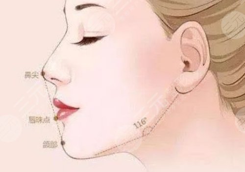 下頜緣提升有什么效果？