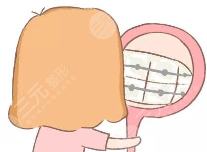 戴牙套