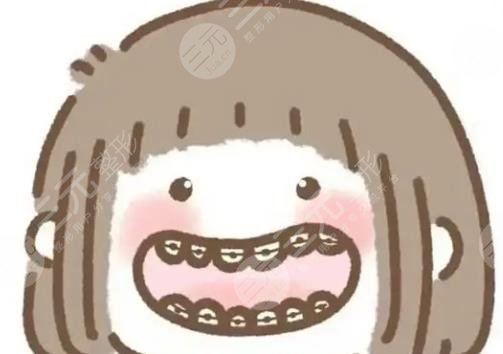 戴牙套