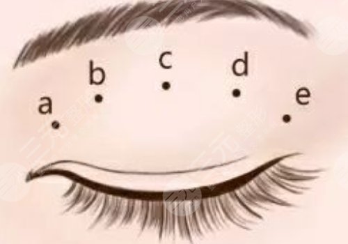 廣州可玉醫(yī)療美容醫(yī)院羅勇怎么樣？