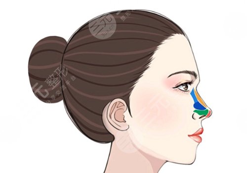 廣州市荔灣區(qū)人民醫(yī)院整形美容隆鼻怎么樣？