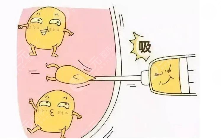 身體塑形能達(dá)到減肥的效果嗎？