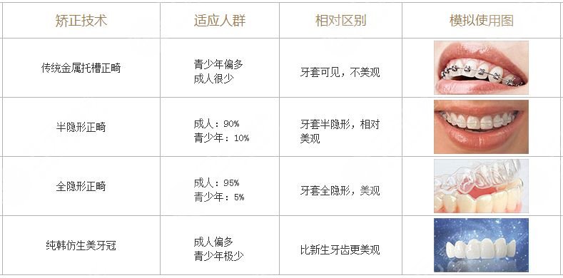 戴牙套