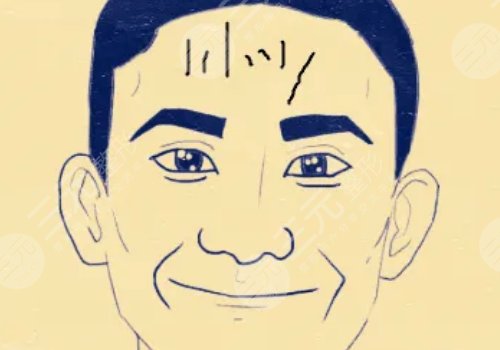 抬頭紋怎么去除有效男生？