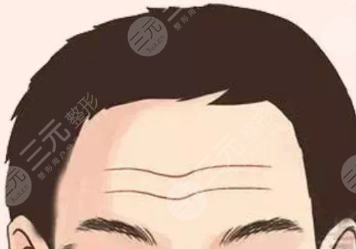 抬頭紋怎么去除有效男生？