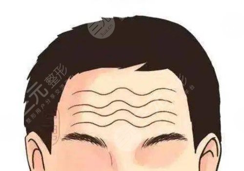 抬頭紋怎么去除有效男生？