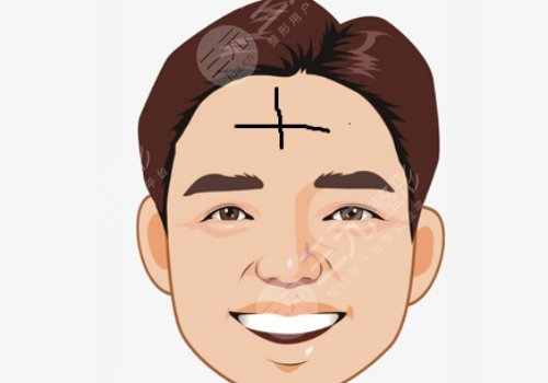 抬頭紋怎么去除有效男生？