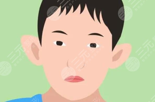 招風耳