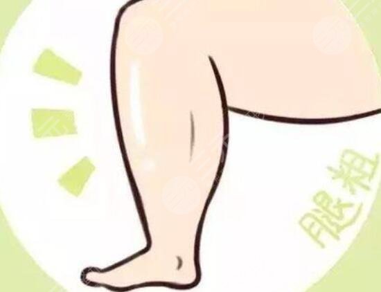 肌肉腿整形