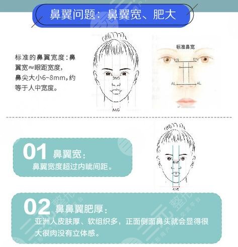 鼻翼縮小
