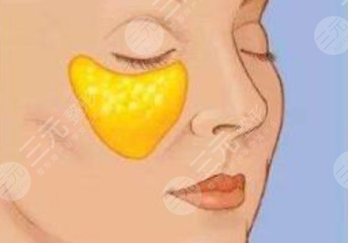 眼窩凹陷用什么填充好？