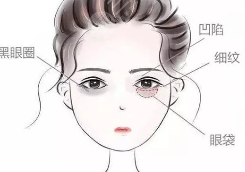 眼窩凹陷用什么填充好？