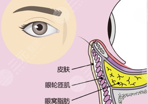 眼窩凹陷用什么填充好？