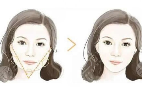 深圳美萊張華彬和黃海龍誰技術(shù)好？