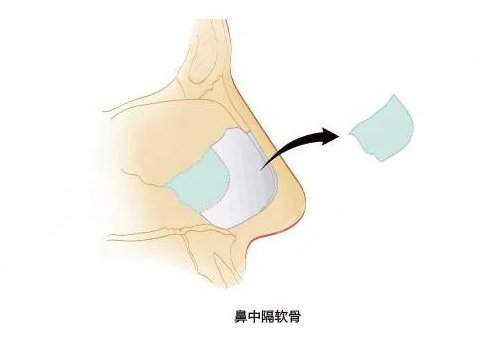 靳玉彪做的鼻子怎么樣？