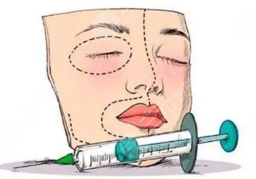 面部打玻尿酸哪里危險(xiǎn)大？