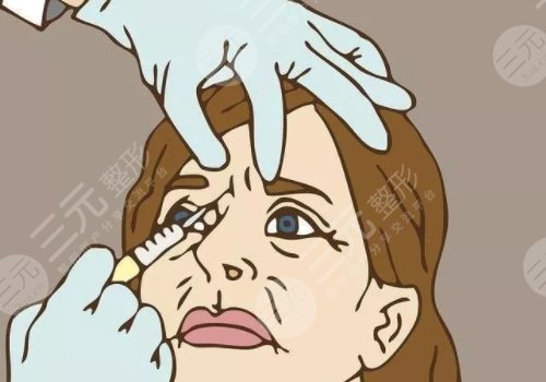 面部打玻尿酸哪里危險(xiǎn)大？