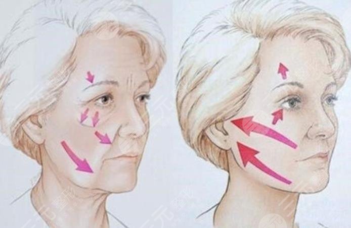 上海林曉曦拉皮拉皮案例