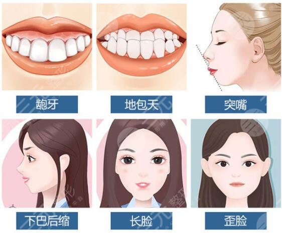 嘴凸法令紋重可以整形嗎？3種改良方案分享，醫(yī)美不盲目！