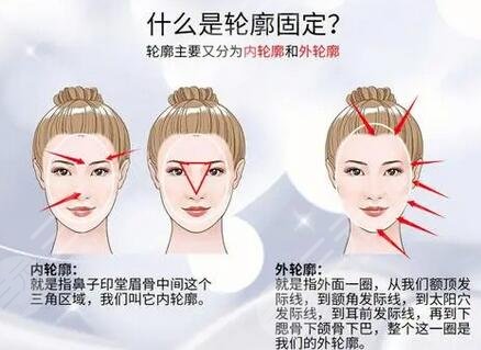 筋膜輪廓固定是什么意思