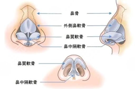 鼻修復(fù)