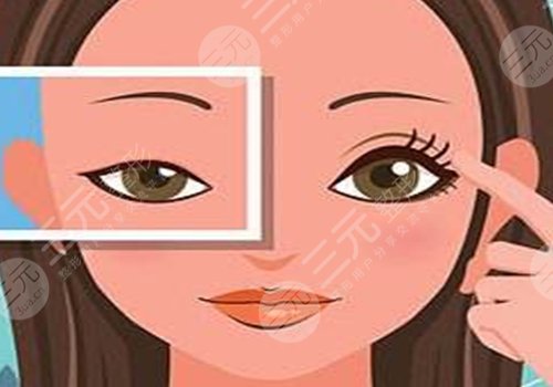 做眼部提拉手術(shù)能維持多久？