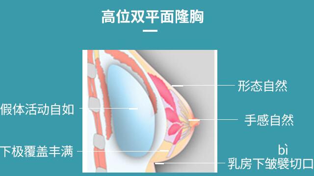 下皺襞隆胸多久恢復(fù)正常，要注意什么？術(shù)前必備科普指南！
