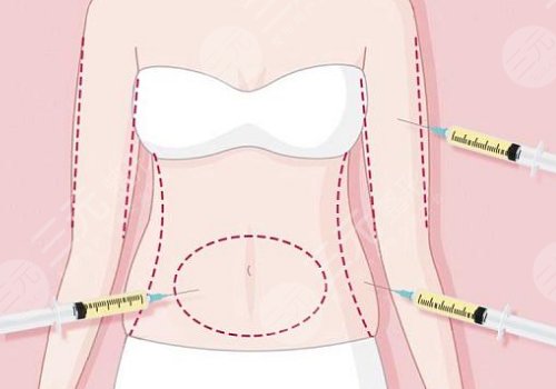 潘紅偉醫(yī)生有名嗎？