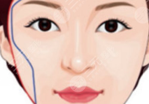 面部輪廓固定怎么做？