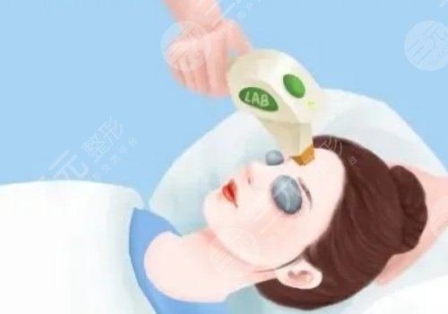 臉部微調包括哪些？