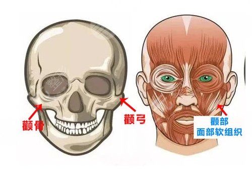磨顴骨手術(shù)一般要多少錢？
