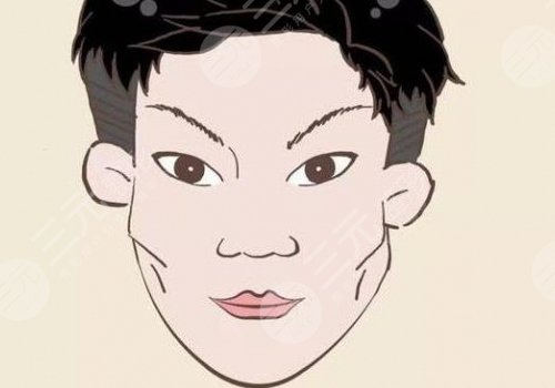 磨顴骨手術(shù)一般要多少錢？