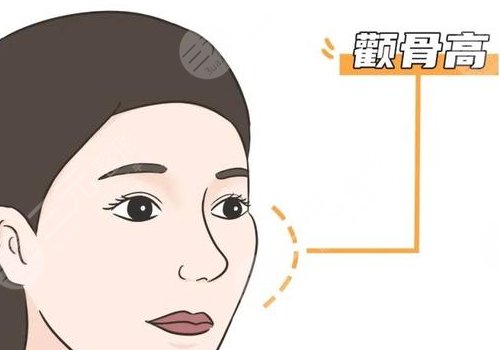 磨顴骨手術(shù)一般要多少錢？