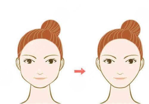 做完輪廓手術(shù)臉更大了怎么回事？
