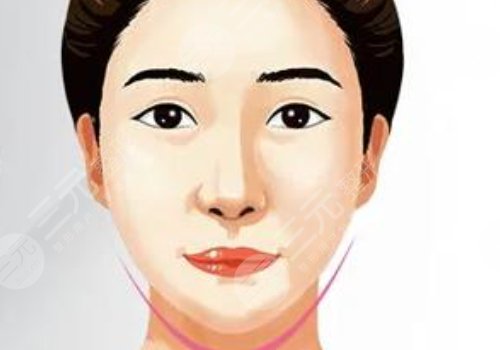 內(nèi)外輪廓固定做手術(shù)要多久？