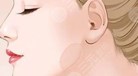 下頜角